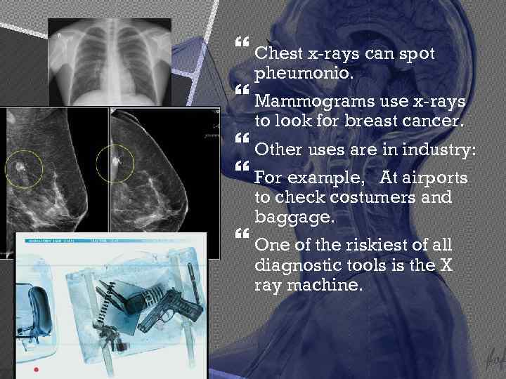  Chest x-rays can spot pheumonio. Mammograms use x-rays to look for breast cancer.