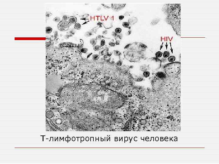 Т-лимфотропный вирус человека 