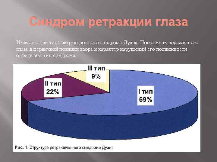 Синдром ретракции глаза Известны три типа ретракционного синдрома Дуана. Положение пораженного глаза в первичной