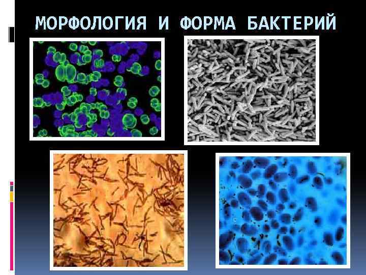 МОРФОЛОГИЯ И ФОРМА БАКТЕРИЙ 