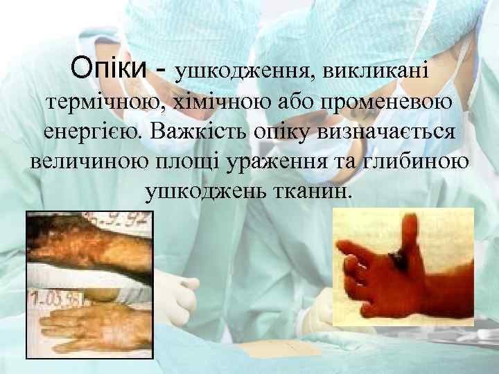 Опіки - ушкодження, викликані термічною, хімічною або променевою енергією. Важкість опіку визначається величиною площі