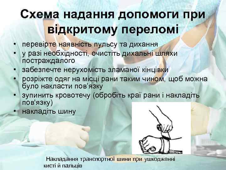 Схема надання допомоги при відкритому переломі • перевірте наявність пульсу та дихання • у