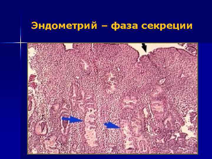 Эндометрий – фаза секреции 