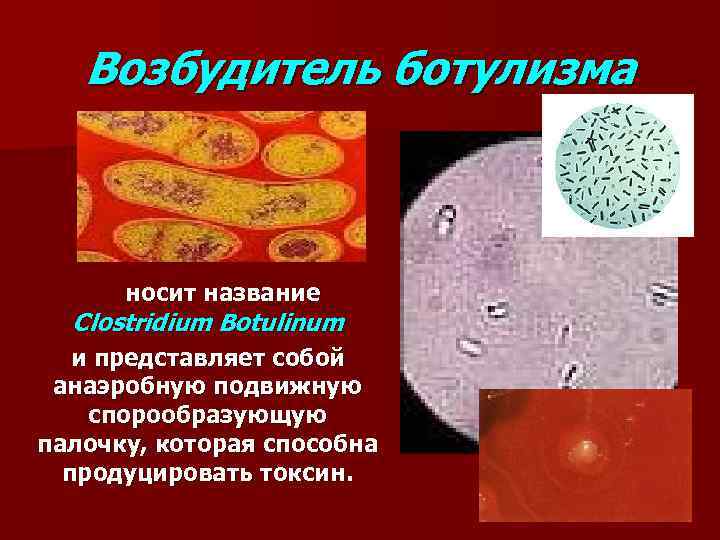 Возбудитель ботулизма носит название Clostridium Botulinum и представляет собой анаэробную подвижную спорообразующую палочку, которая