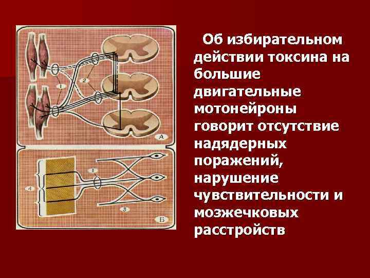 Об избирательном действии токсина на большие двигательные мотонейроны говорит отсутствие надядерных поражений, нарушение чувствительности