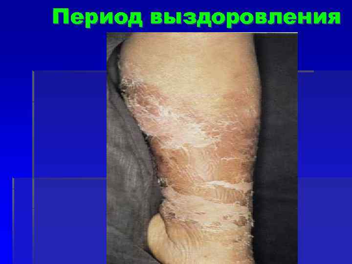 Период выздоровления 