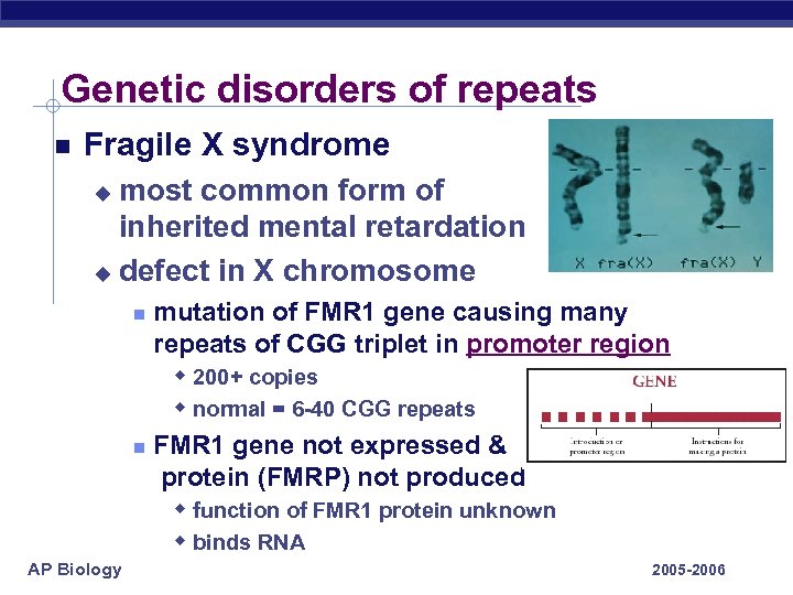 Genetic disorders of repeats Fragile X syndrome most common form of inherited mental retardation