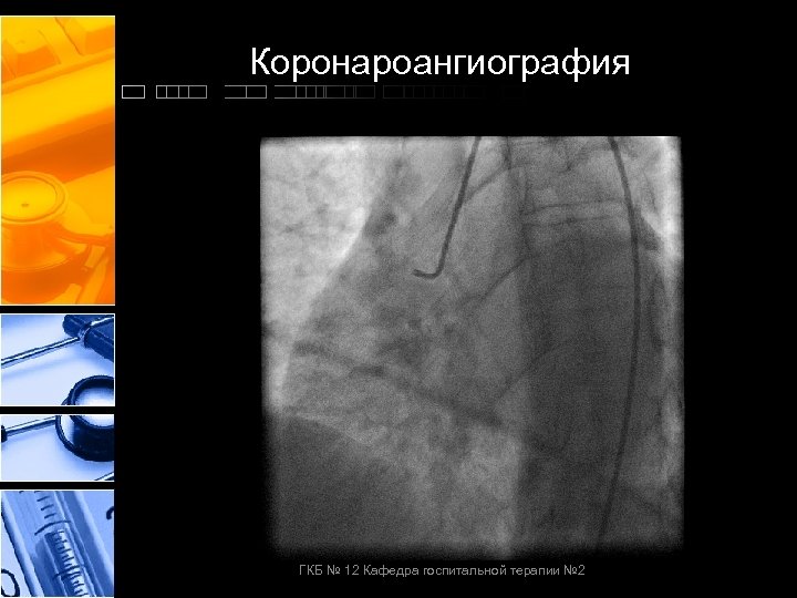  Коронароангиография ГКБ № 12 Кафедра госпитальной терапии № 2 