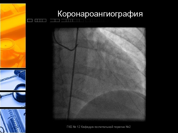 Коронароангиография ГКБ № 12 Кафедра госпитальной терапии № 2 