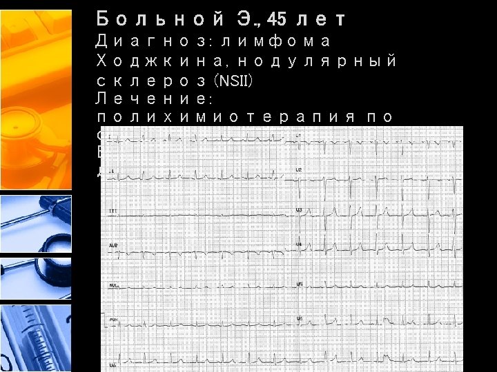 Больной Э. , 45 лет Диагноз: лимфома Ходжкина, нодулярный склероз (NSII) Лечение: полихимиотерапия по
