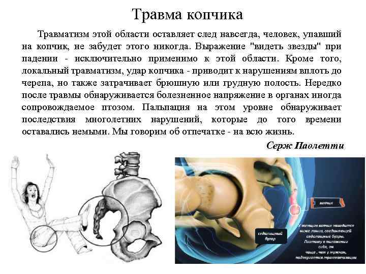 Травма копчика Травматизм этой области оставляет след навсегда, человек, упавший на копчик, не забудет