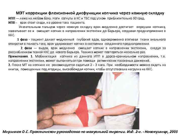 МЭТ коррекции флексионной дисфункции копчика через кожную складку ИПП — лежа на любом боку.