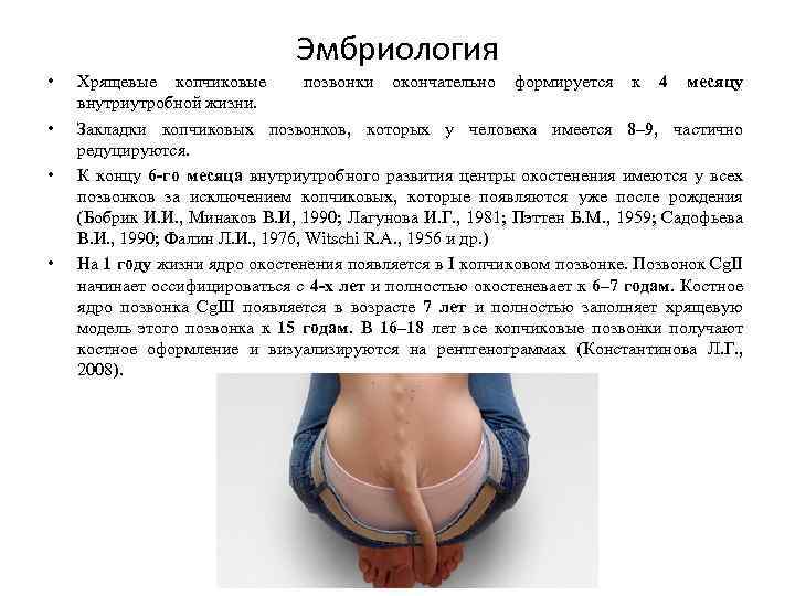 Эмбриология • • Хрящевые копчиковые позвонки окончательно формируется к 4 месяцу внутриутробной жизни. Закладки