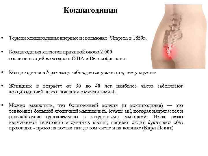 Кокцигодиния • Термин кокцигодиния впервые использовал Simpson в 1859 г. • Кокцигодиния является причиной