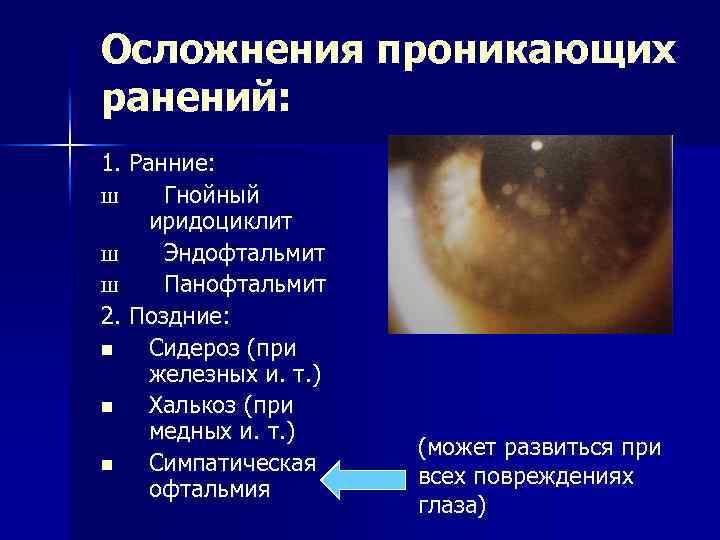 Осложнения проникающих ранений: 1. Ранние: Ш Гнойный иридоциклит Ш Эндофтальмит Ш Панофтальмит 2. Поздние: