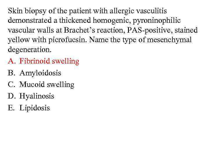 Skin biopsy of the patient with allergic vasculitis demonstrated a thickened homogenic, pyroninophilic vascular