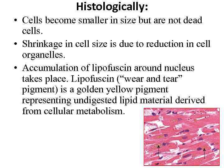Histologically: • Cells become smaller in size but are not dead cells. • Shrinkage