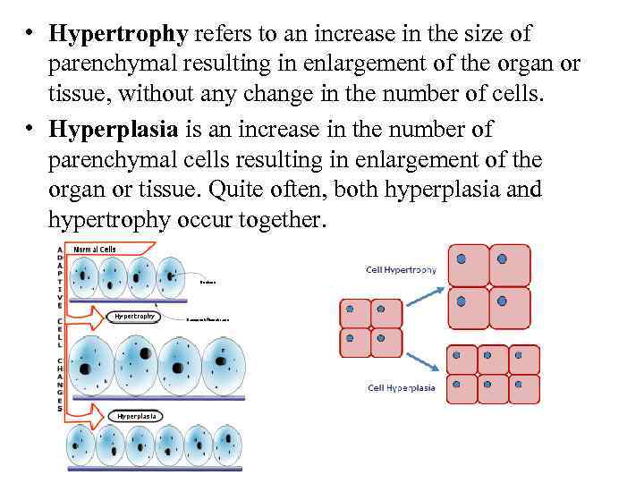  • Hypertrophy refers to an increase in the size of parenchymal resulting in