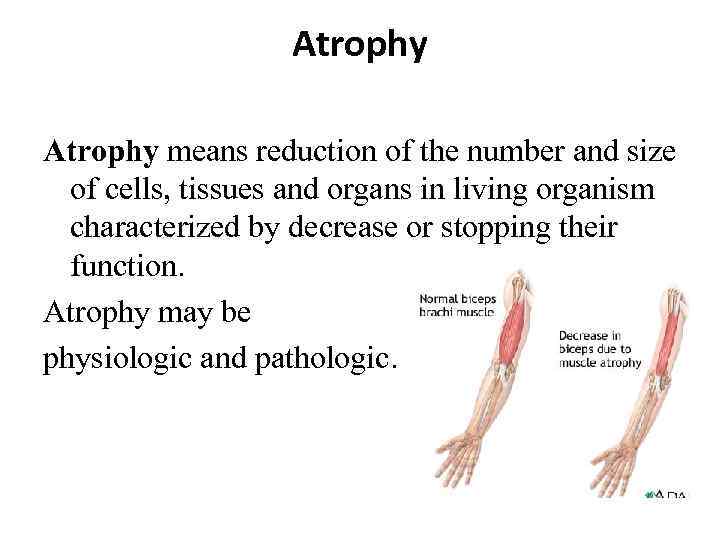 Atrophy means reduction of the number and size of cells, tissues and organs in