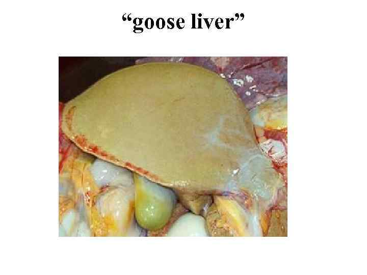 “goose liver” 