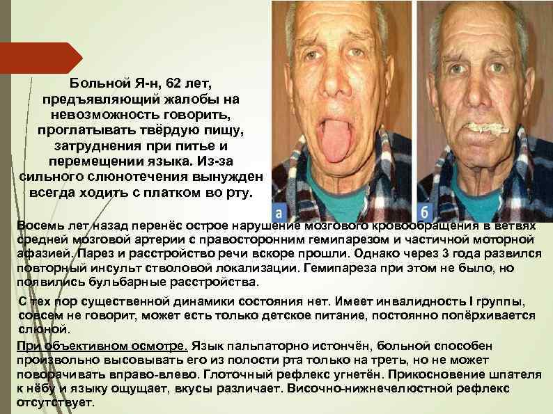 Больной Я-н, 62 лет, предъявляющий жалобы на невозможность говорить, проглатывать твёрдую пищу, затруднения при