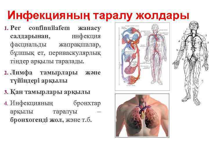 Инфекцияның таралу жолдары 1. Per confinuilafem жанасу салдарынан, инфекция фасциальды жапрақшалар, бұлшық ет, периваскулярлық