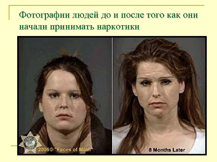 Фотографии людей до и после того как они начали принимать наркотики 