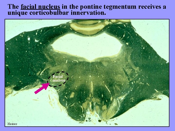 The facial nucleus in the pontine tegmentum receives a unique corticobulbar innervation. Facial nucleus