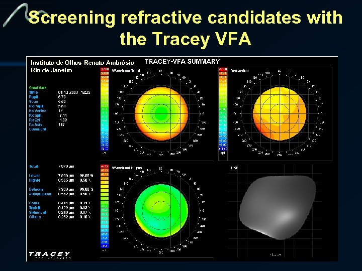 Screening refractive candidates with the Tracey VFA Instituto de Olhos Renato Ambrósio Rio de