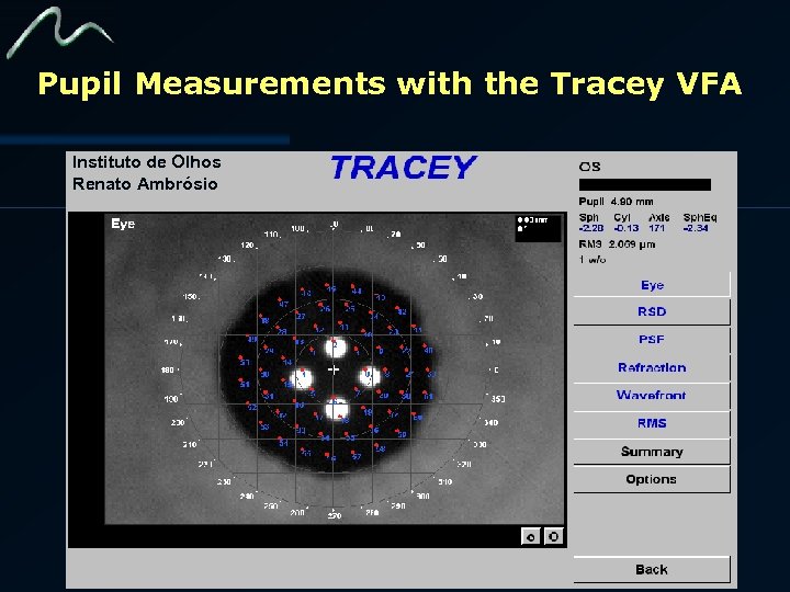 Pupil Measurements with the Tracey VFA Instituto de Olhos Renato Ambrósio 