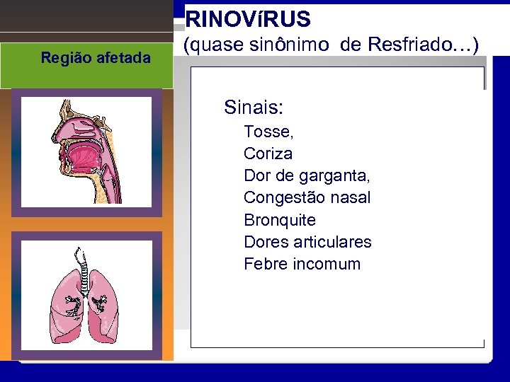 RINOVíRUS Região afetada (quase sinônimo de Resfriado…) Sinais: Tosse, Coriza Dor de garganta, Congestão