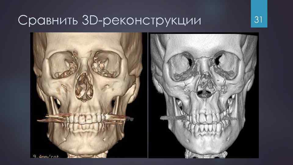Сравнить 3 D-реконструкции 31 