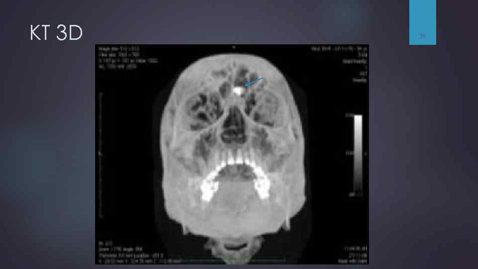 КТ 3 D 39 