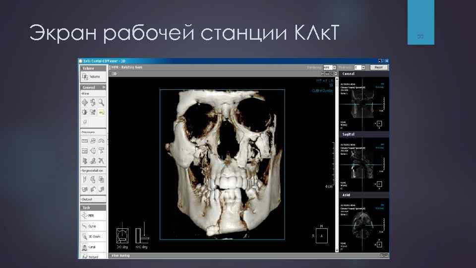Экран рабочей станции КЛк. Т 55 