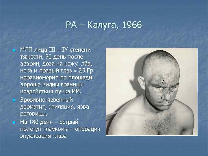 РА – Калуга, 1966 n n n МЛП лица III – IY степени тяжести,