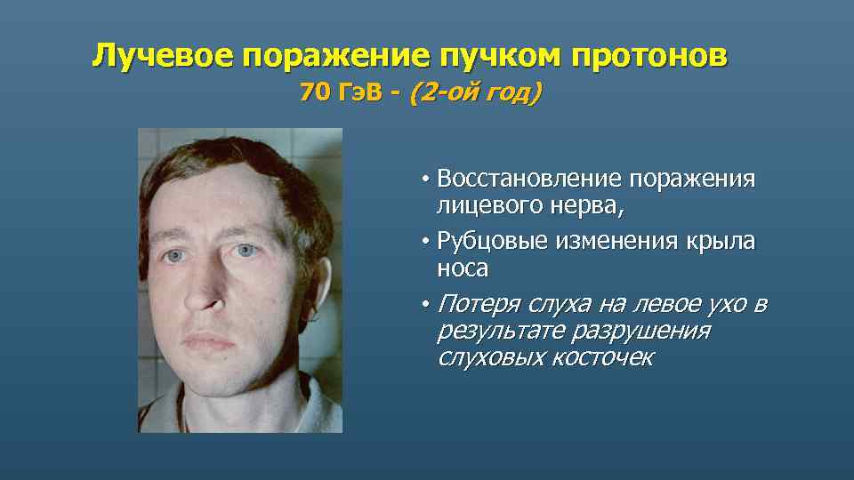Лучевое поражение пучком протонов 70 Гэ. В - (2 -ой год) • Восстановление поражения