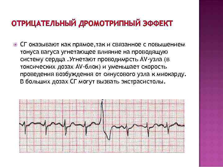 ОТРИЦАТЕЛЬНЫЙ ДРОМОТРИПНЫЙ ЭФФЕКТ СГ оказывают как прямое, так и связанное с повышением тонуса вагуса