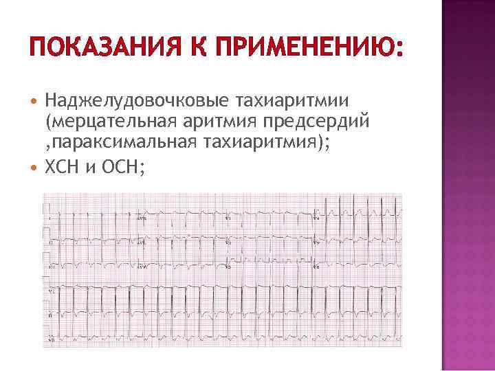 ПОКАЗАНИЯ К ПРИМЕНЕНИЮ: Наджелудовочковые тахиаритмии (мерцательная аритмия предсердий , параксимальная тахиаритмия); ХСН и ОСН;