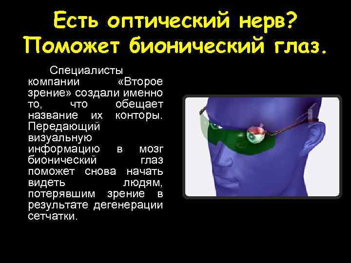 Есть оптический нерв? Поможет бионический глаз. Специалисты компании «Второе зрение» создали именно то, что