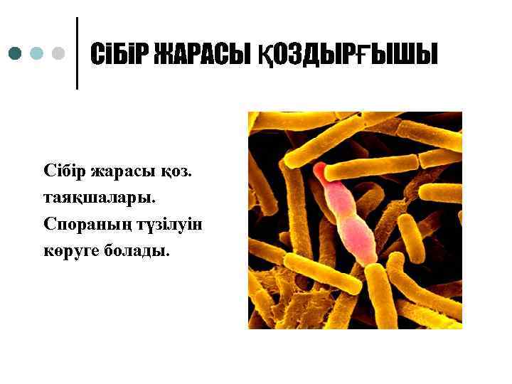 СіБіР ЖАРАСЫ ҚОЗДЫРҒЫШЫ Сібір жарасы қоз. таяқшалары. Спораның түзілуін көруге болады. 