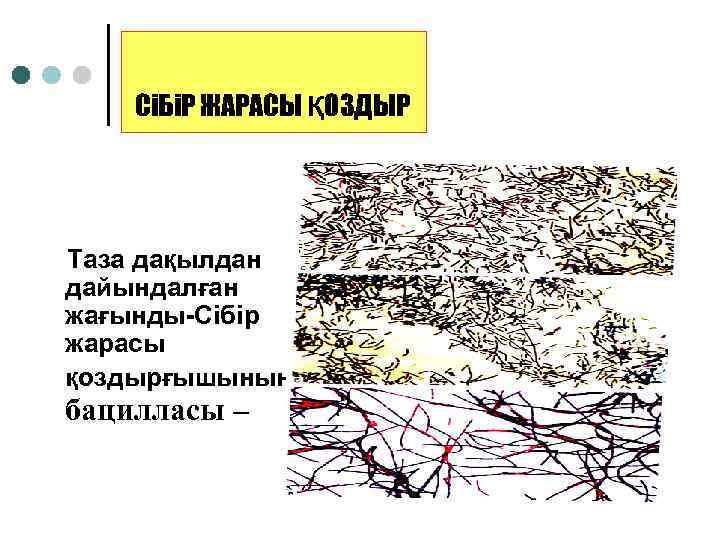 СіБіР ЖАРАСЫ ҚОЗДЫР Таза дақылдан дайындалған жағынды-Сібір жарасы қоздырғышының бацилласы – 