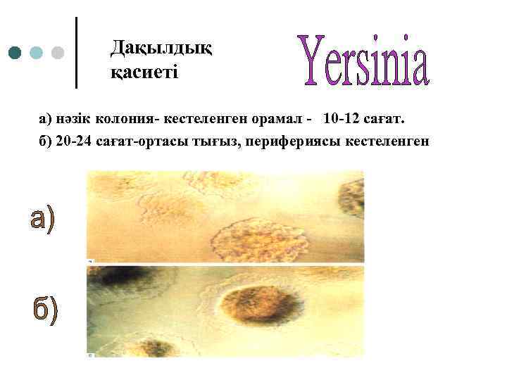 Дақылдық қасиеті а) нәзік колония- кестеленген орамал - 10 -12 сағат. б) 20 -24