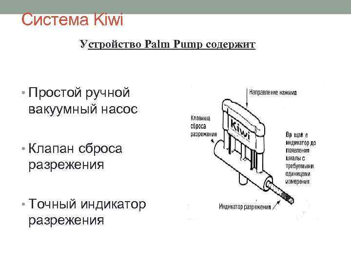 Вакуум экстракция презентация