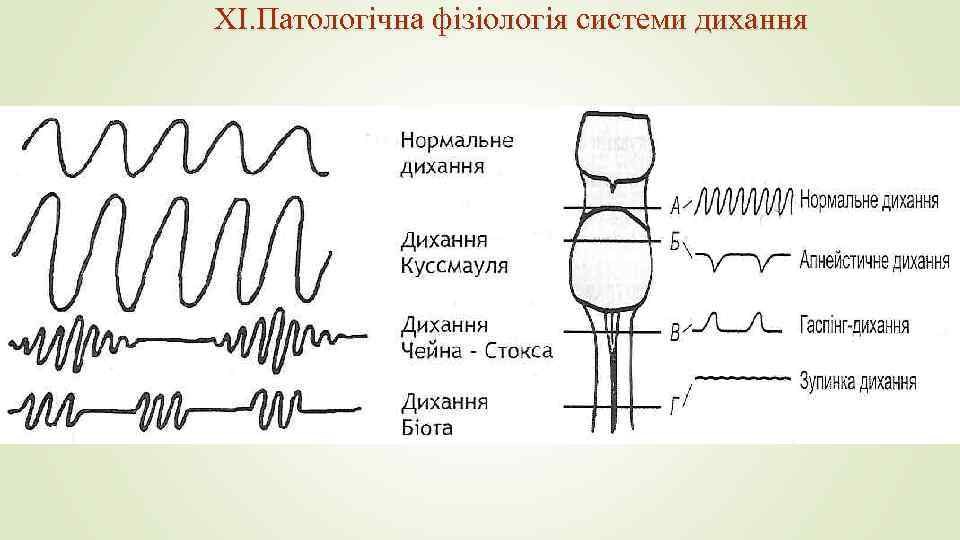 XI. Патологічна фізіологія системи дихання 