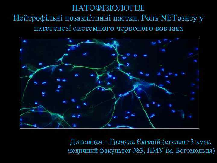 ПАТОФІЗІОЛОГІЯ. Нейтрофільні позаклітинні пастки. Роль NETозису у патогенезі системного червоного вовчака Доповідач – Гречуха