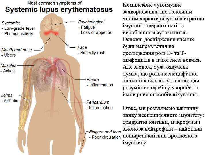 Комплексне аутоімунне захворювання, що головним чином характеризується втратою імунної толерантності та виробленням аутоантитіл. Основні