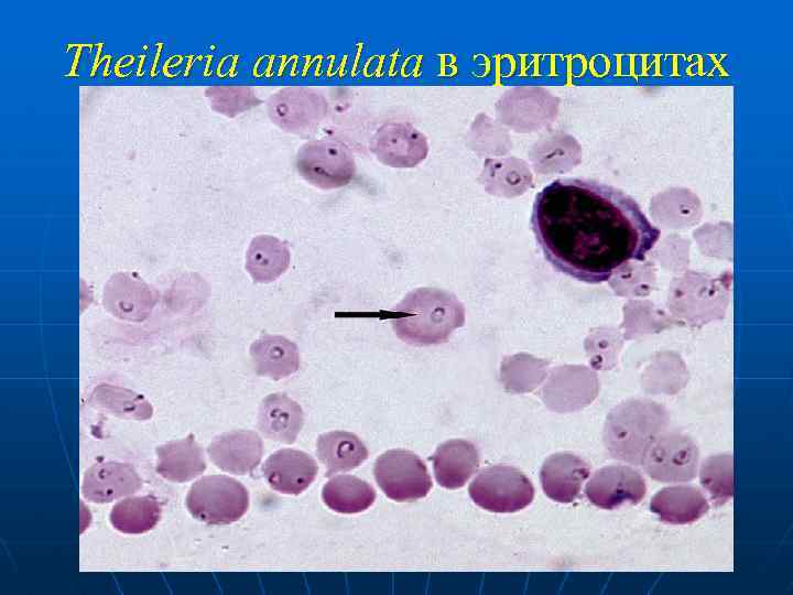 Theileria annulata в эритроцитах 