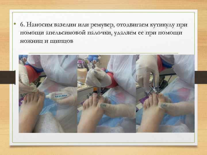  • 6. Наносим вазелин или ремувер, отодвигаем кутикулу при помощи апельсиновой палочки, удаляем