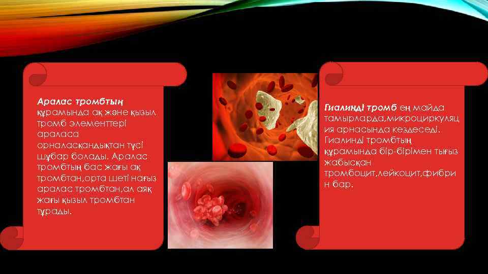 Аралас тромбтың құрамында ақ және қызыл тромб элементтері араласа орналасқандықтан түсі шұбар болады. Аралас