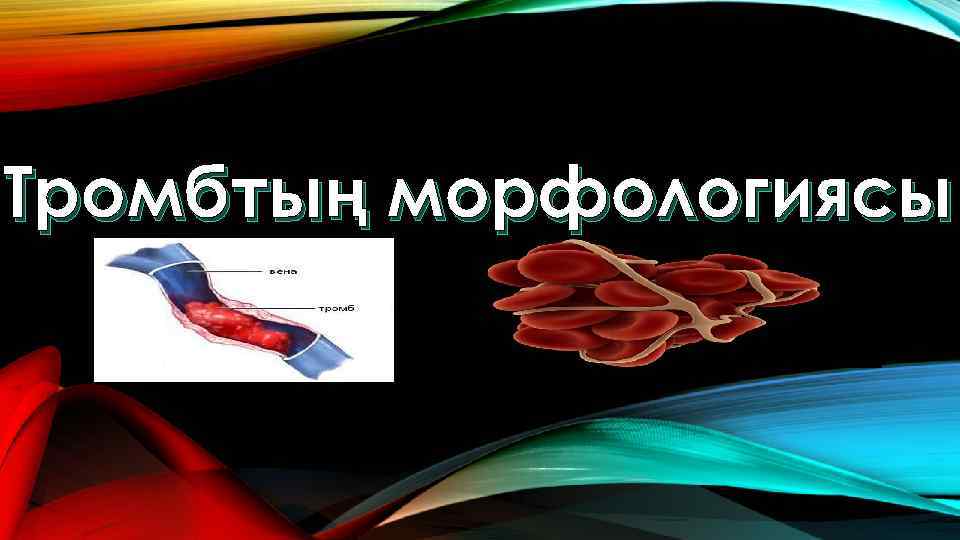 Тромбтың морфологиясы 